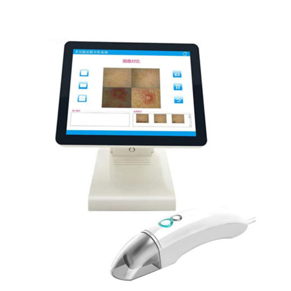 Multi function Skin Analysis S